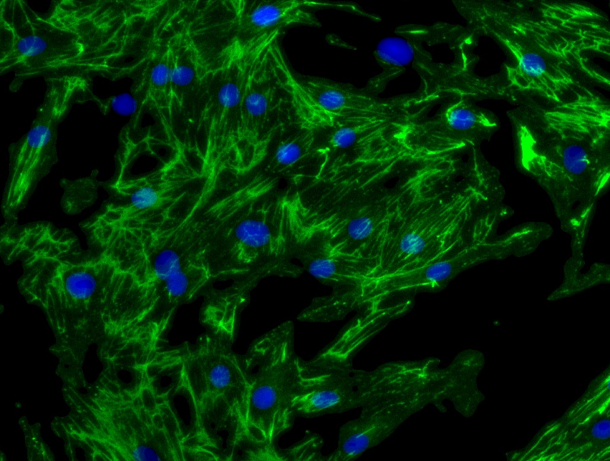 Fibrosis assay