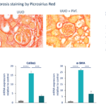 Renal Fibrosis model - UUO Model