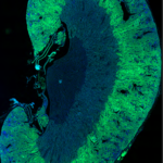Kidney Preclinical research
