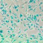 Kidney Preclinical research