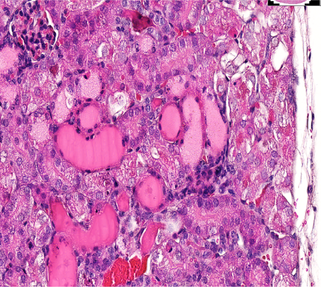 Cisplatin induced AKI model