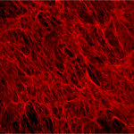 Extracellular Matrix staining