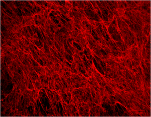 Extracellular Matrix staining