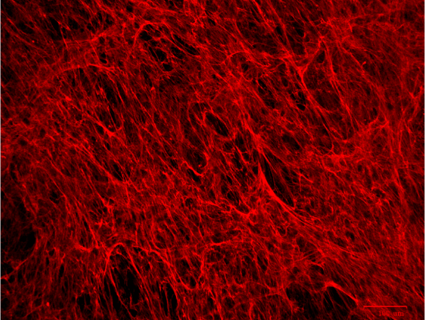 Extracellular Matrix staining