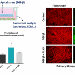 Firbosis assay readouts