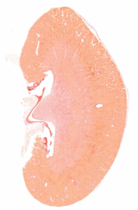 Renal Fibrosis staining