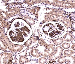 Kidney Preclinical research