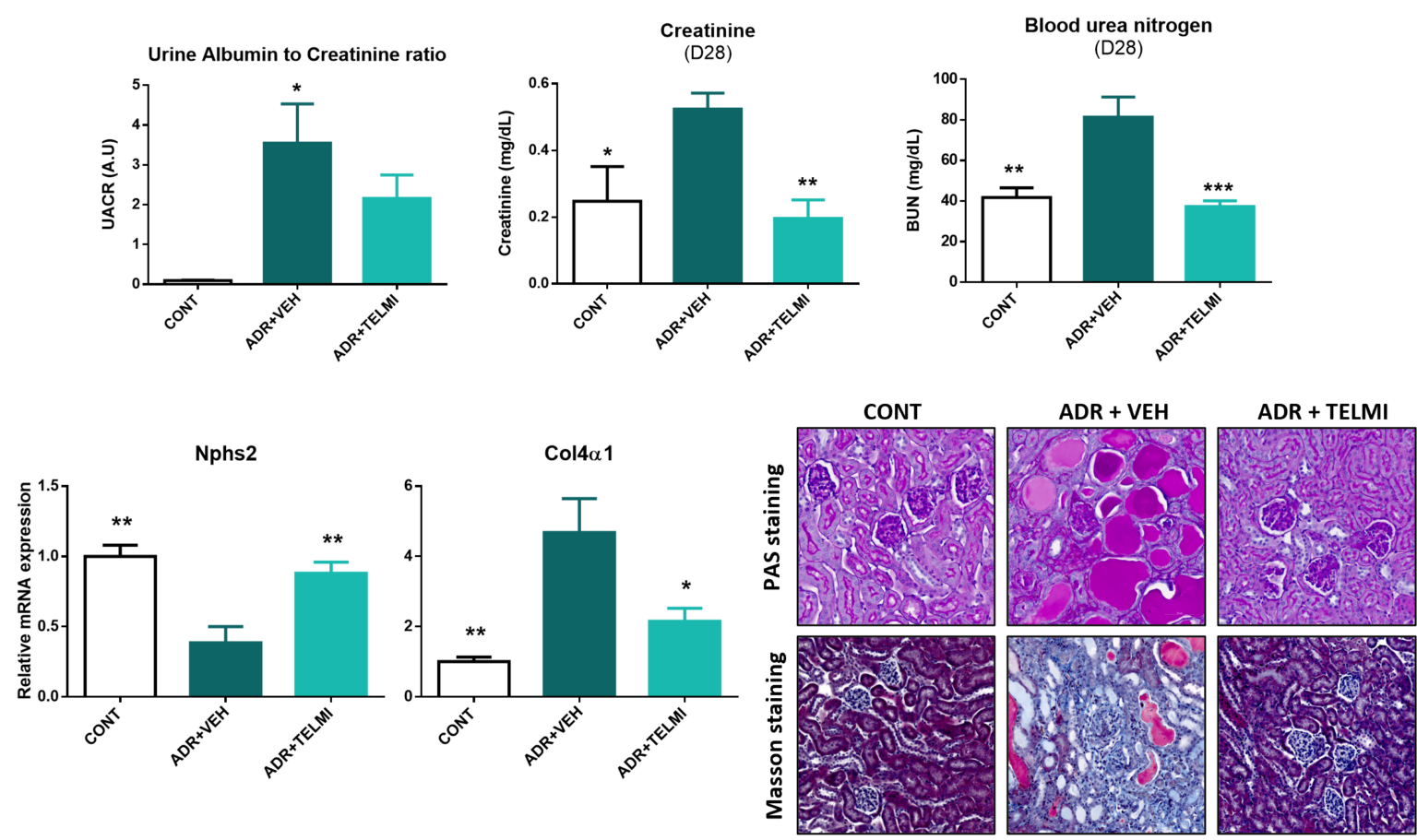 Study readouts on Adriamycin-Induced FSGS Model