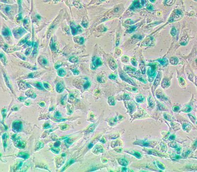 Senessence assay