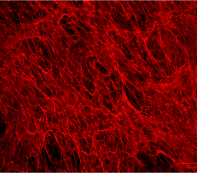 Extracellular Matrix staining