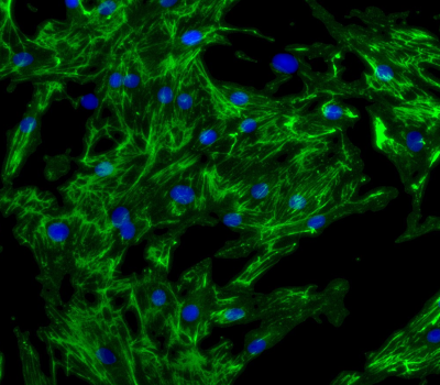 Fibrosis