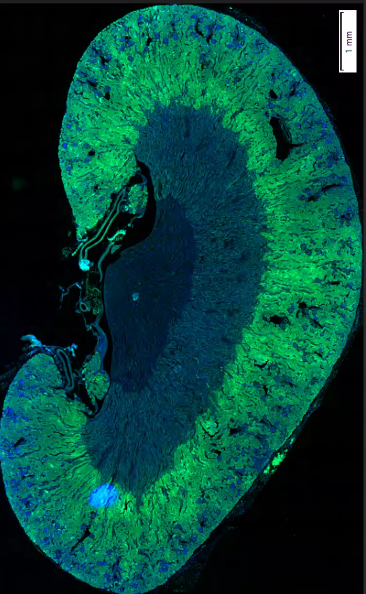 Kidney Preclinical research