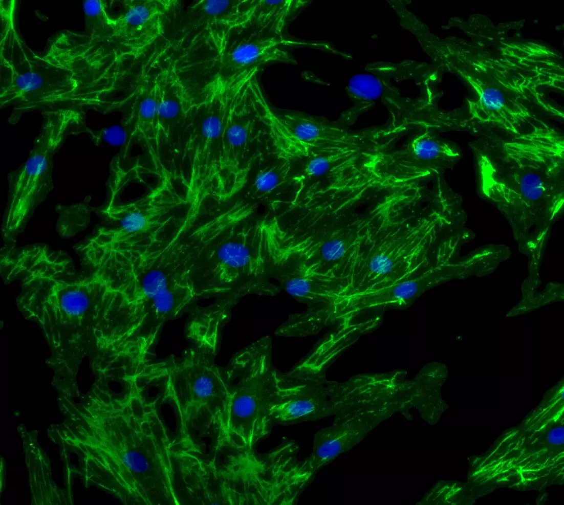 Kidney Preclinical research